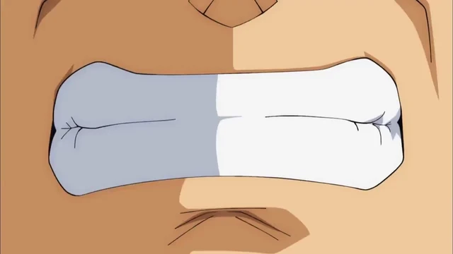 Episódio 24
