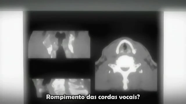 Episódio 09