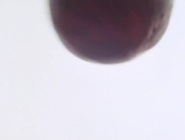 Episódio 11