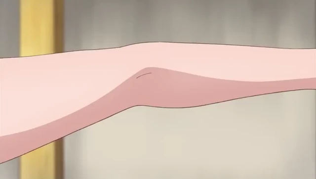 Episódio 03