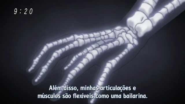 Episódio 30