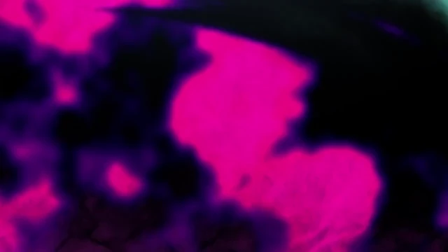 Episódio 11