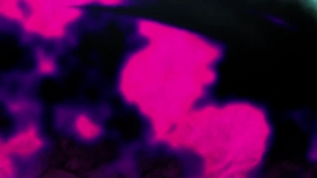 Episódio 11