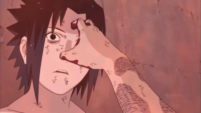 Episódio 370