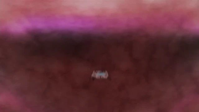 Episódio 30