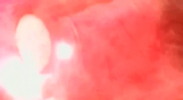 Episódio 22